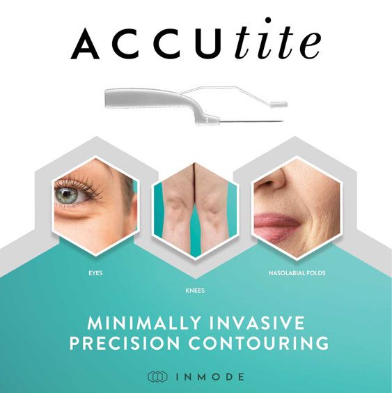 AccuTite Procedure