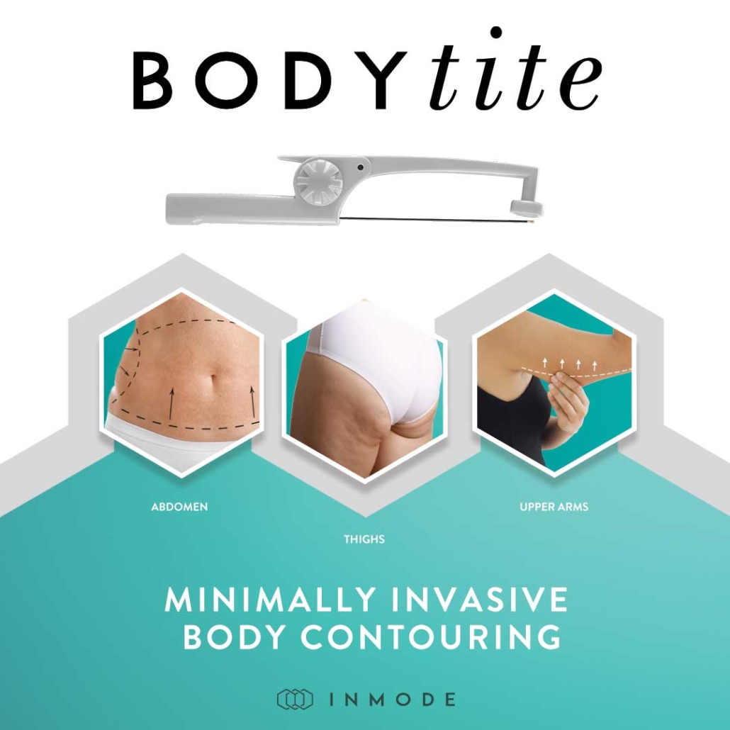 BodyTite Procedure