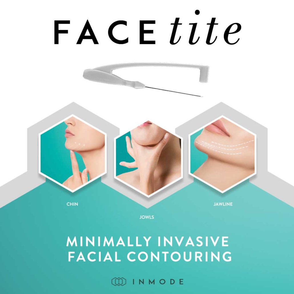 FaceTite Procedure